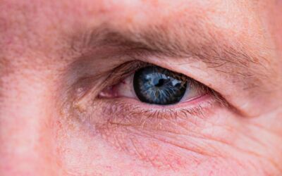 Did You Know That Your Eyes Can Get Sunburned?