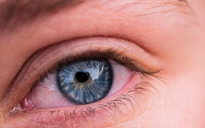 How Seasonal Allergies Affect Your Eyes in Fall?